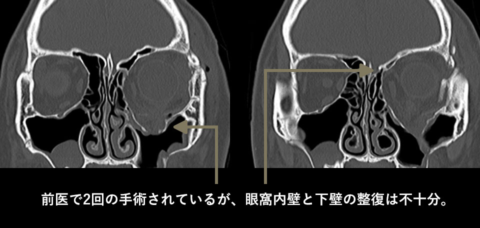 術前