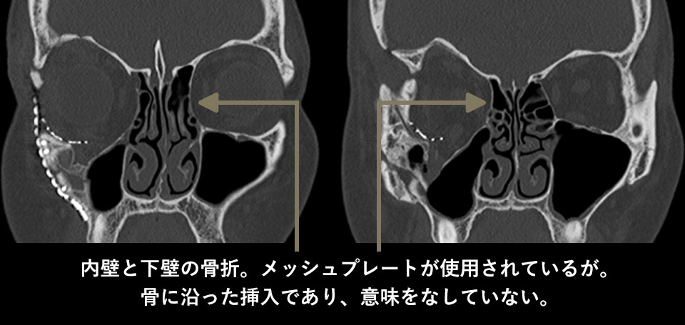 術前