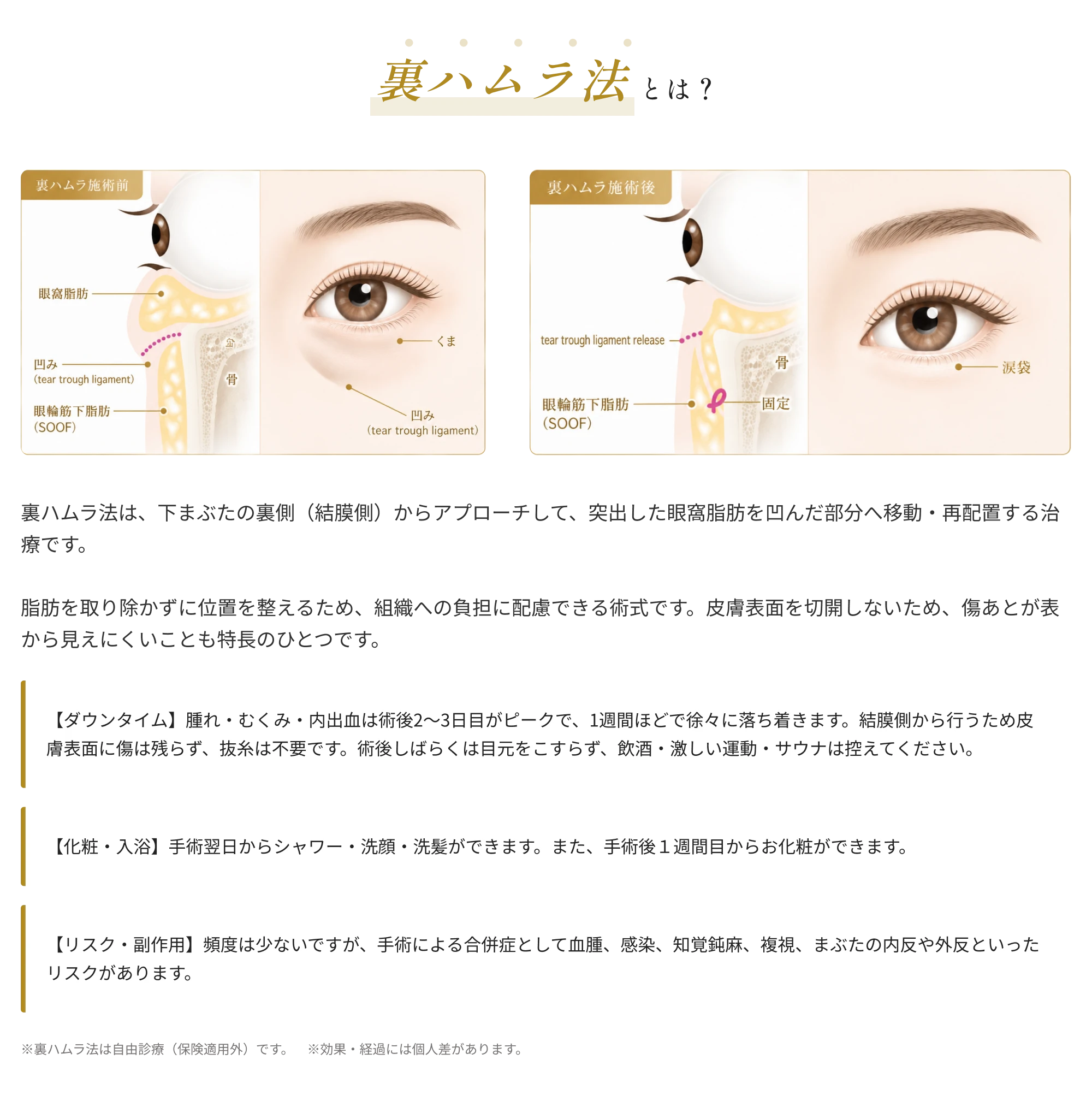 裏ハムラ法とは?