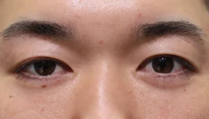 After