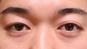 Before