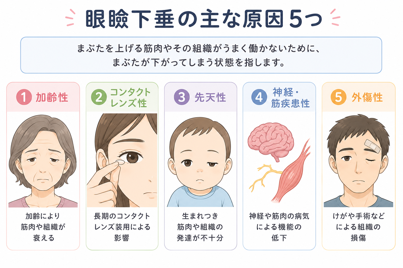 眼瞼下垂の５つの要因