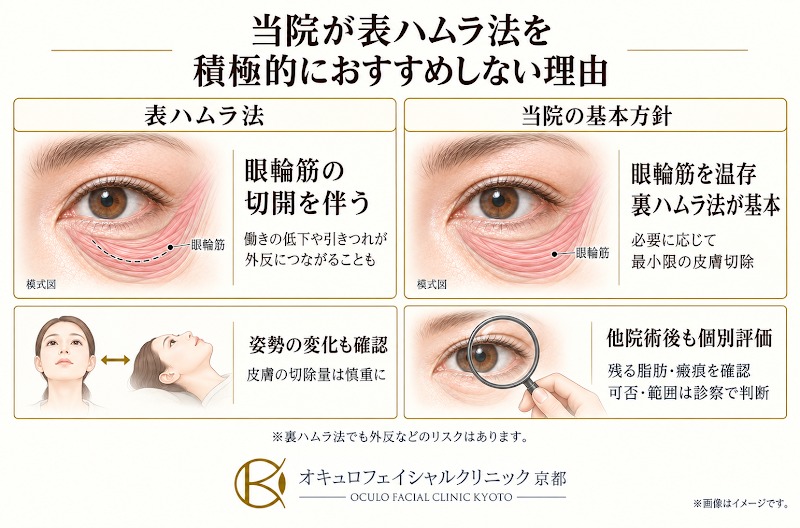 当院が表ハムラ法をおすすめしない理由を示した図
