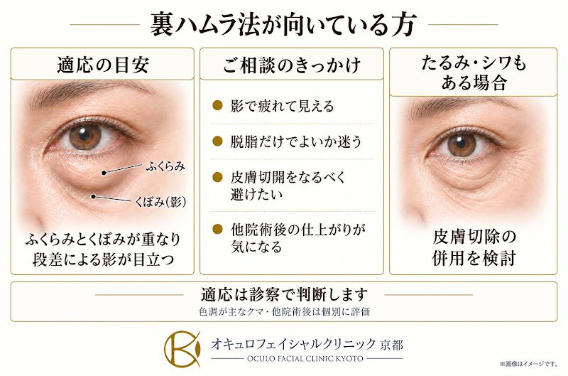 目の下のふくらみとくぼみが重なって影ができているなど、裏ハムラ法が向いている方の目安を示した図